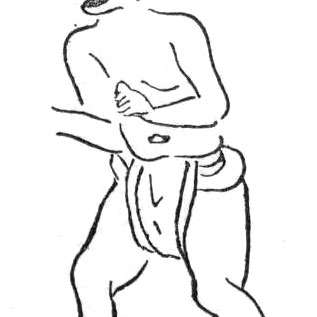 胃宿の画像[1]サムネイル